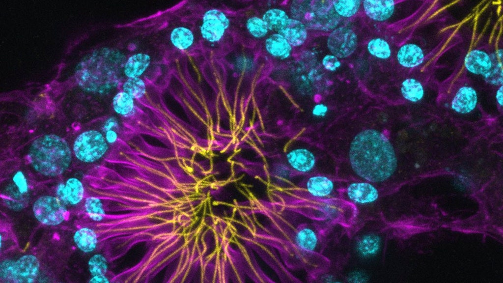 Image en fluorescence de cellules avec noyaux bleus et structures jaunes et violettes.