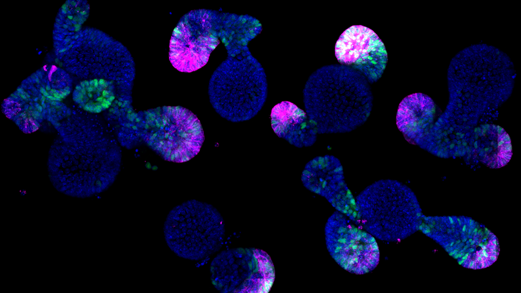 Image microscopique de structures cellulaires bleues avec des zones marquées en vert et en magenta sur fond noir.